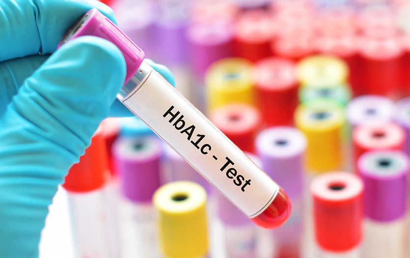 Dashboard 835 Lab hemoglobin-A1C