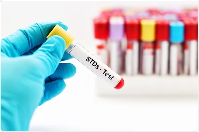 STD-Testing