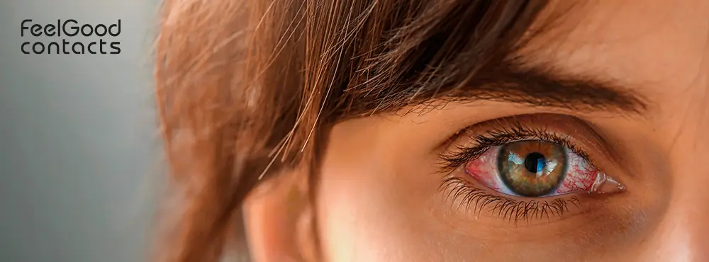how-to-remove-contact-lenses